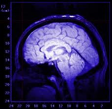 Un supercomputer per curare il cervello 